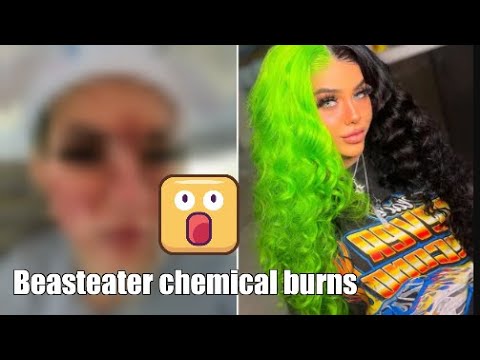  beasteater chemical burns video